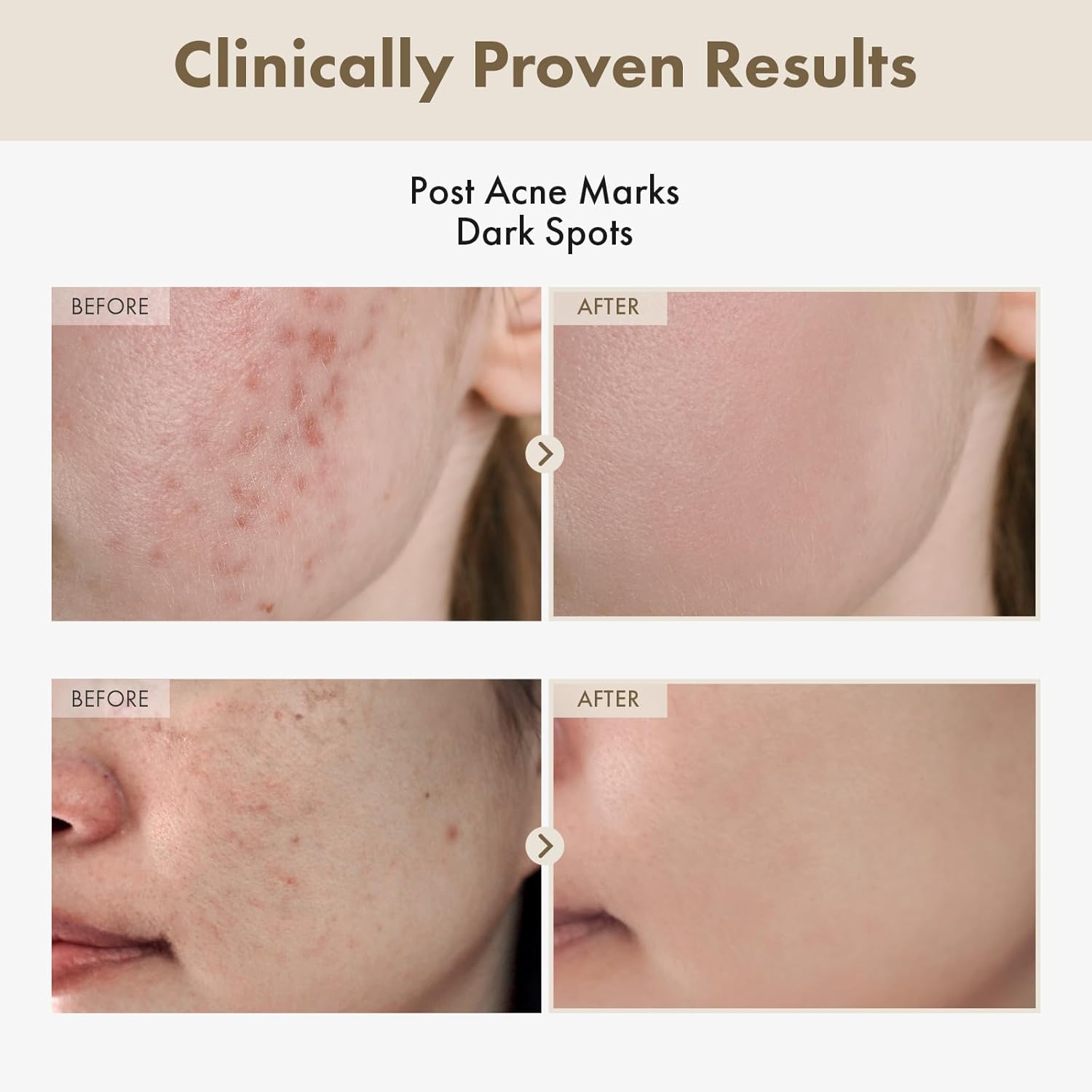 TOSOWOONG Alpha Arbutin 2% Rice Serum, Rice 746,074ppm, Alpha-Arbutin 20,000ppm, Glow, Glass Skin, Even Skin Tone, Hydrating, Korean Skin Care, 33ml / 1.11 fl.oz