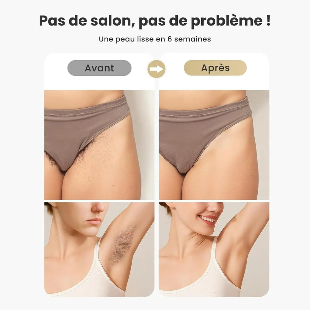 Before and after pubic and armpit hair removal results in 6 weeks