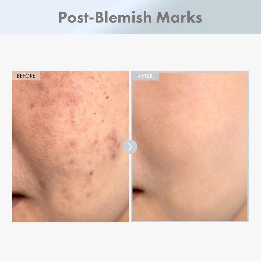 TOSOWOONG Niacinamide 15% Face Serum, 150,100ppm Niacinamide, Tranexamic acid, Supports Even Skin Tone, Glass Skin, Radiant Complexion, Refines Appearance of Pores, Korean Skin Care, 30ml, 1.01 fl.oz