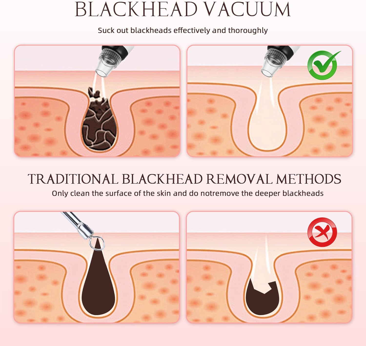 LENND Blackhead Remover Pore Vacuum, Blackhead Extractor Tool Facial Pore Cleaner Electric Comedone Whitehead Extractor Tool-5 Suction Power,5 Probes,USB Rechargeable Blackhead Vacuum Kit