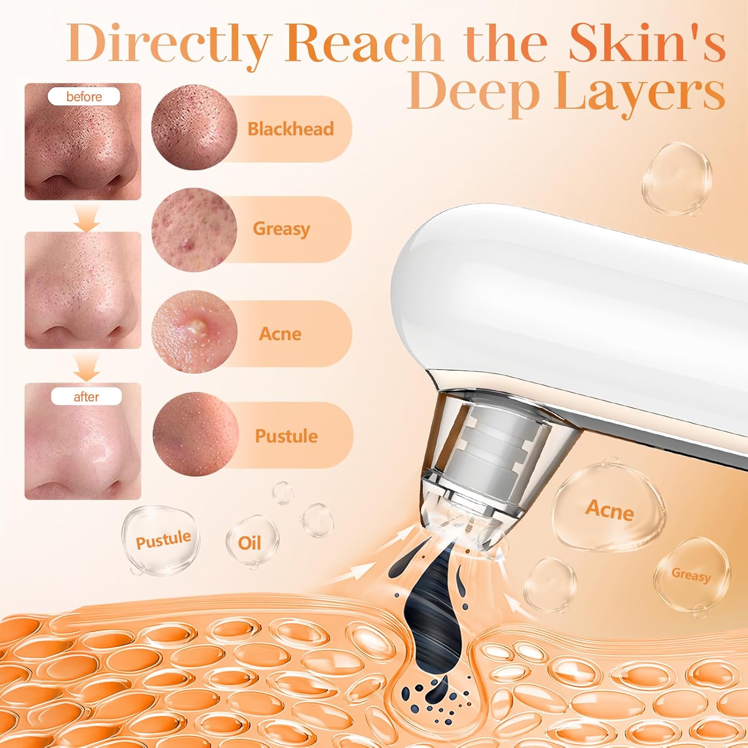 Yccu Professional Blackhead Aspirator, Electric Blackhead for Facial Cleansing and Pore Removal, Pimples and Impurities Suction with 4 Heads and 4 Suction Modes, Blackhead Remover Vacuum