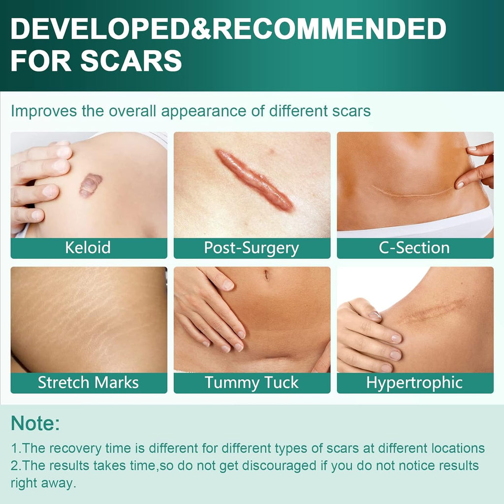 Silicone Scar Sheets, Silicone Scar Tape (1.6"x 120" Roll-3M), Reusable and Effective Scar Removal Sheets, Silicone Scar Removal Sheets for Surgical Scars, Healing Keloid, C-Section, Tummy Tuck