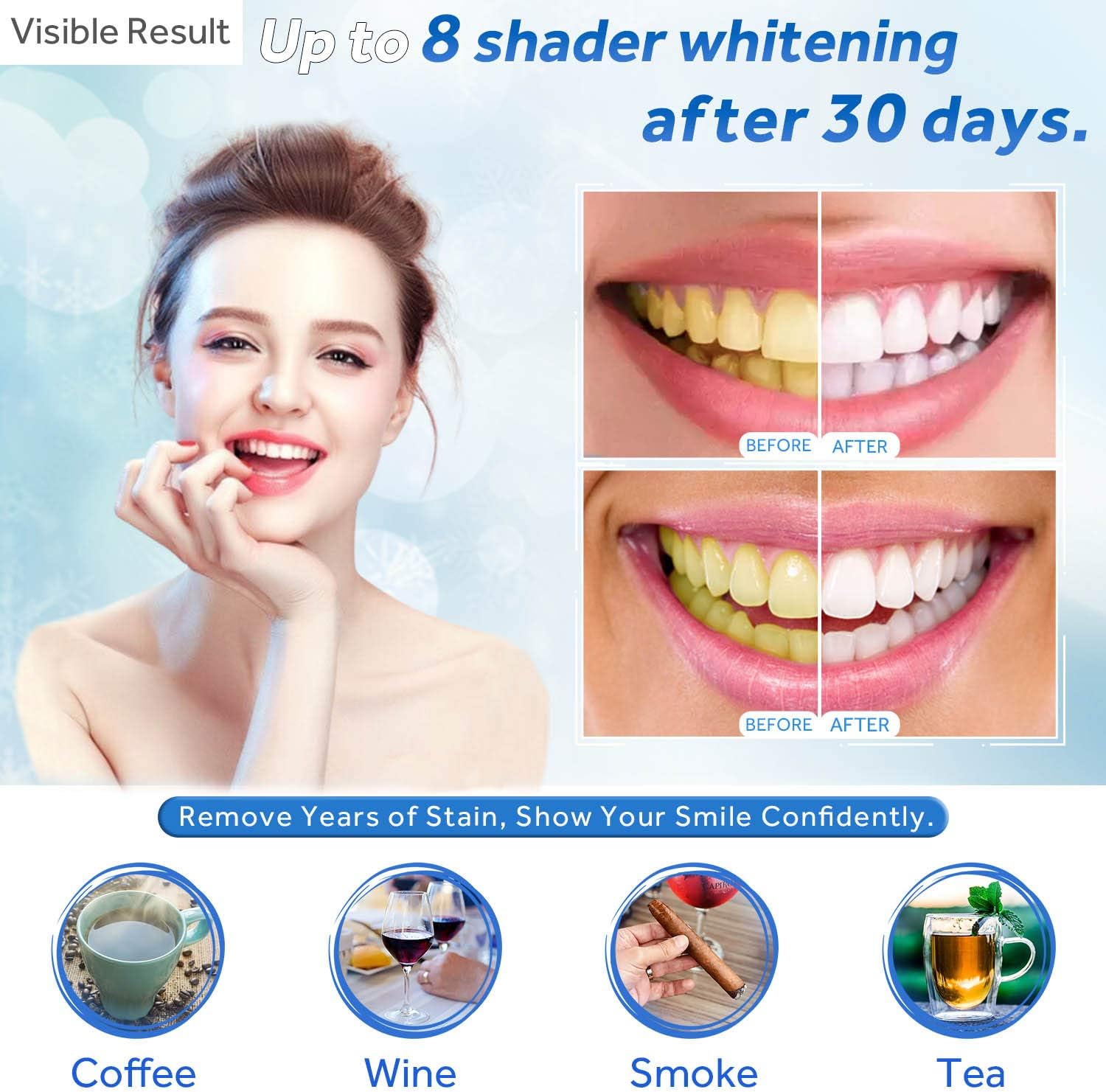 EZGO Teeth Whitening Gel Syringe, 22% Carbamide Peroxide, (10) 5ml Syringes, No Sensitivity