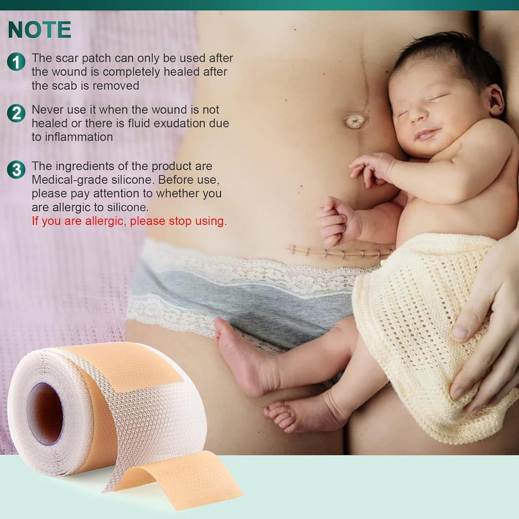 Silicone Scar Sheets, Silicone Scar Tape (1.6"x 120" Roll-3M), Reusable and Effective Scar Removal Sheets, Silicone Scar Removal Sheets for Surgical Scars, Healing Keloid, C-Section, Tummy Tuck