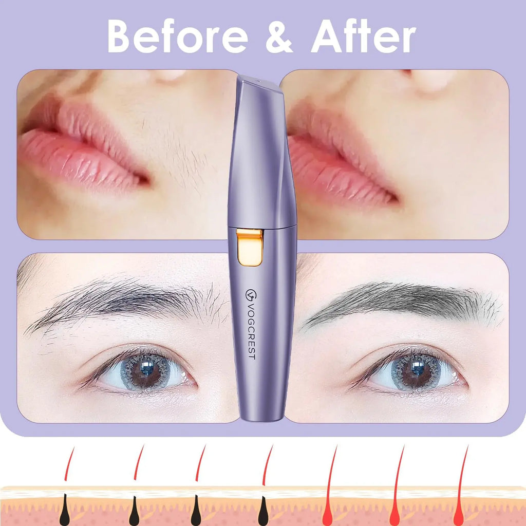Before and after results of fine hair removal on eyebrows and upper lip with device diagram