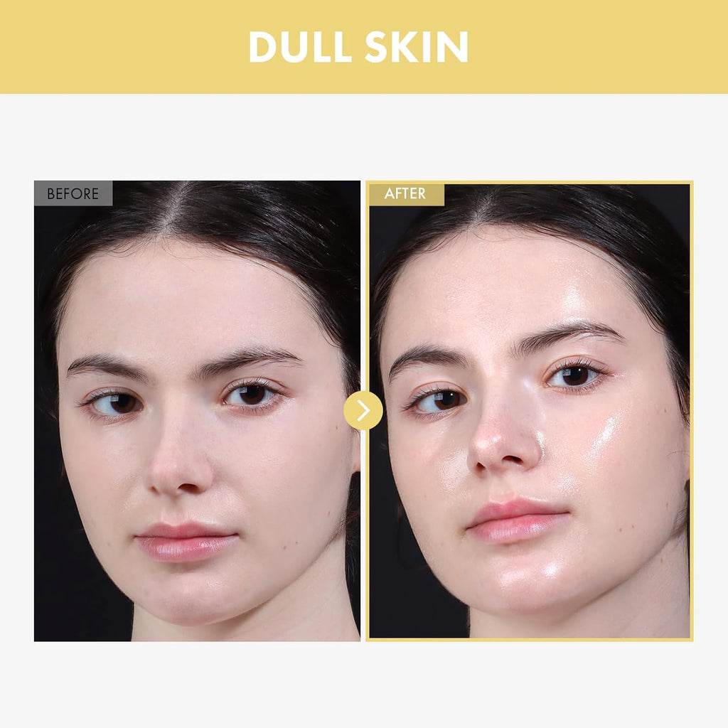 TOSOWOONG Glow Bean Essence, 31,025ppm Soybean Ferment Extract, Glass Skin, Exfoliating, Hydrating, Radiant, Moisturizer, Barrier, Face Serum, Korean Skin Care, 33ml / 1.11 fl. oz