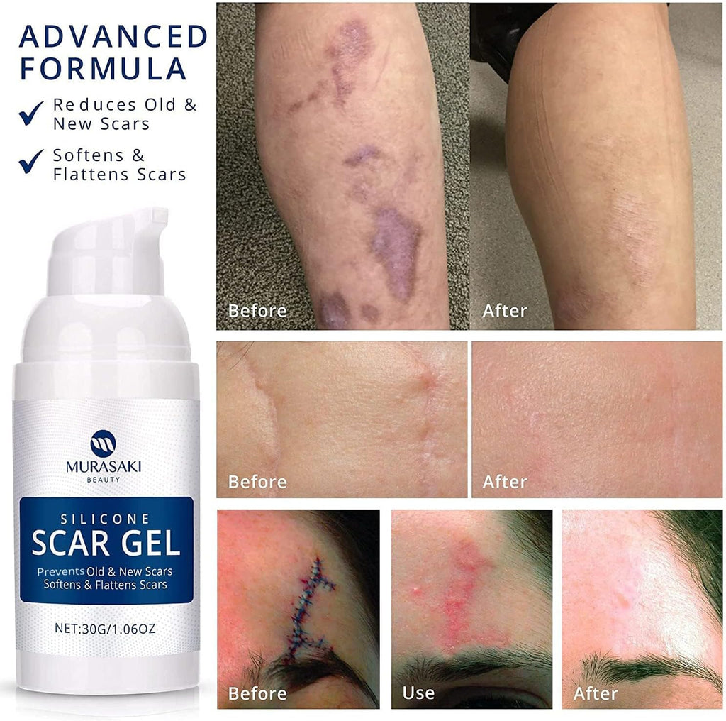 MURASAKI BEAUTY Scar Gel silicone scar gel from C-Section, Stretch Marks, Acne, Surgery, Effective for both Old and New Scars