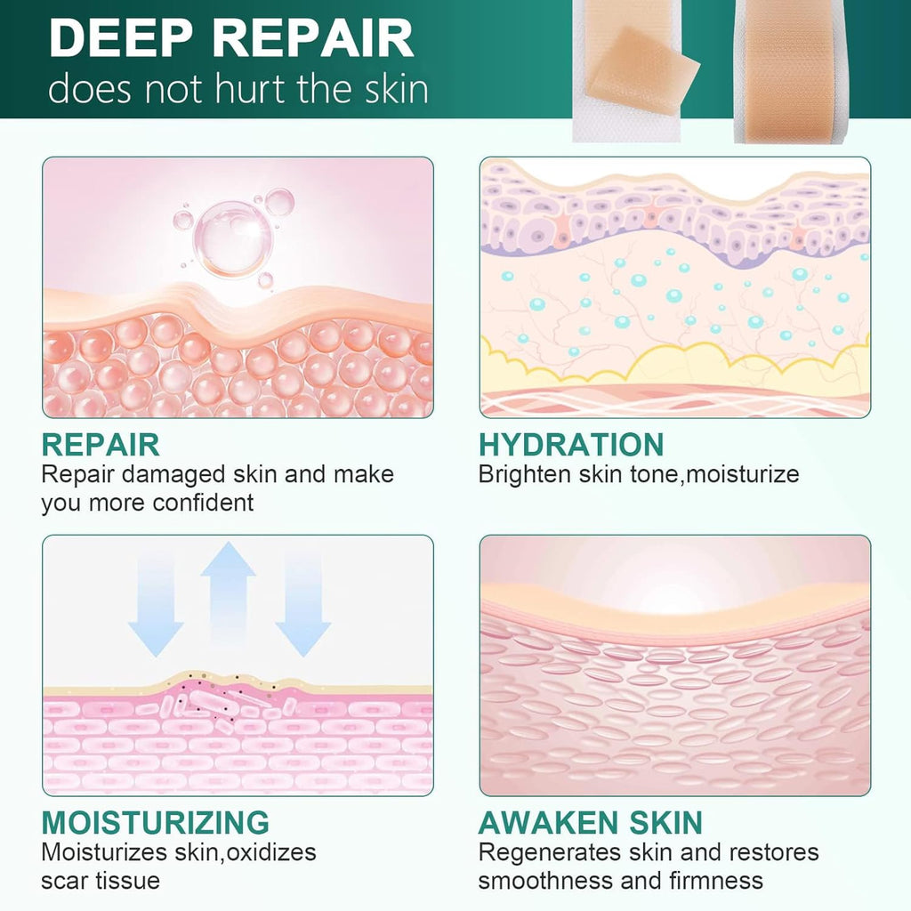 Silicone Scar Sheets, Silicone Scar Tape (1.6"x 120" Roll-3M), Reusable and Effective Scar Removal Sheets, Silicone Scar Removal Sheets for Surgical Scars, Healing Keloid, C-Section, Tummy Tuck