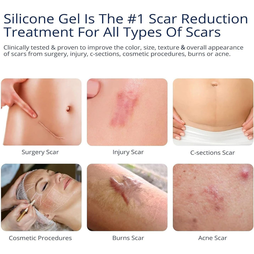 MURASAKI BEAUTY Scar Gel silicone scar gel from C-Section, Stretch Marks, Acne, Surgery, Effective for both Old and New Scars