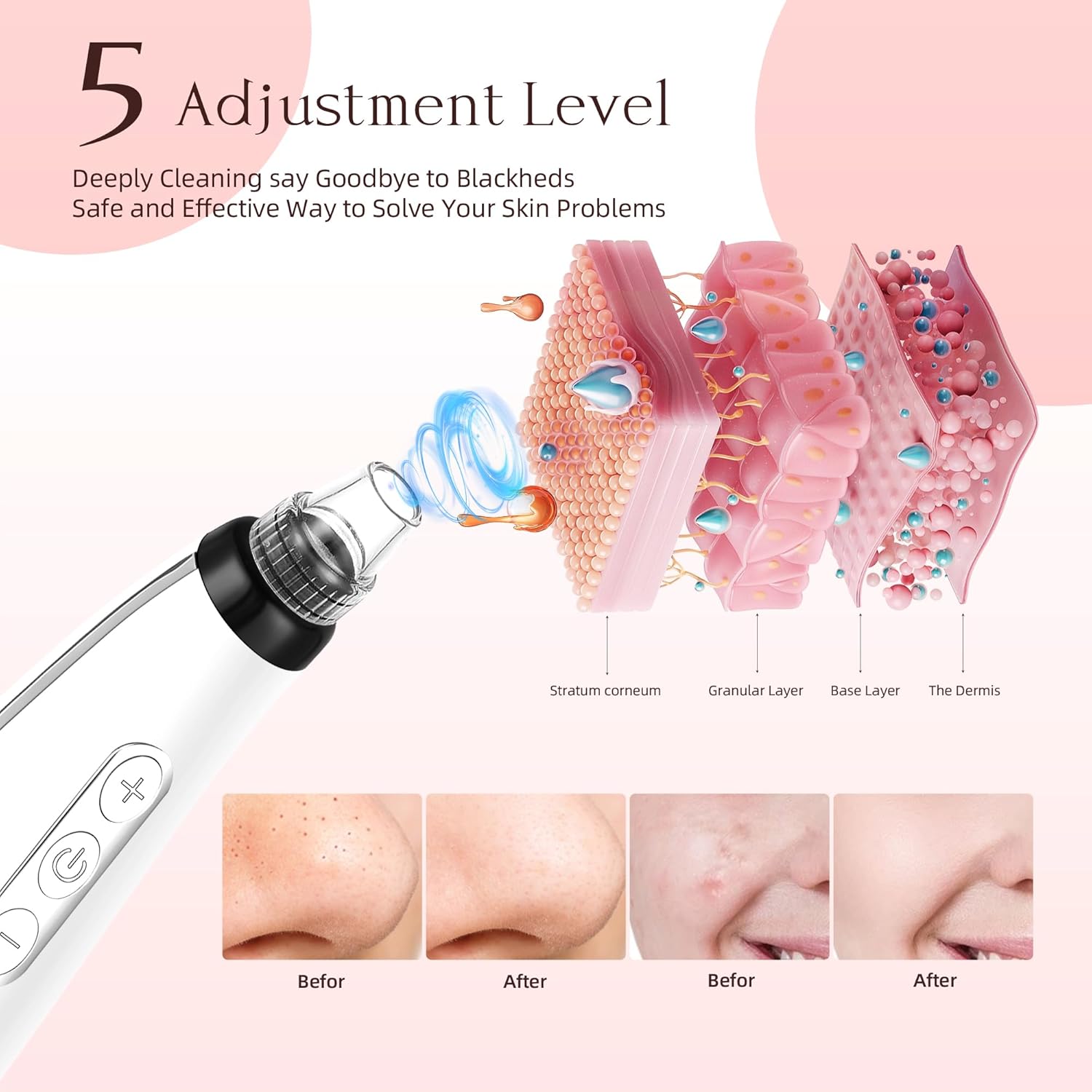 LENND Blackhead Remover Pore Vacuum, Blackhead Extractor Tool Facial Pore Cleaner Electric Comedone Whitehead Extractor Tool-5 Suction Power,5 Probes,USB Rechargeable Blackhead Vacuum Kit