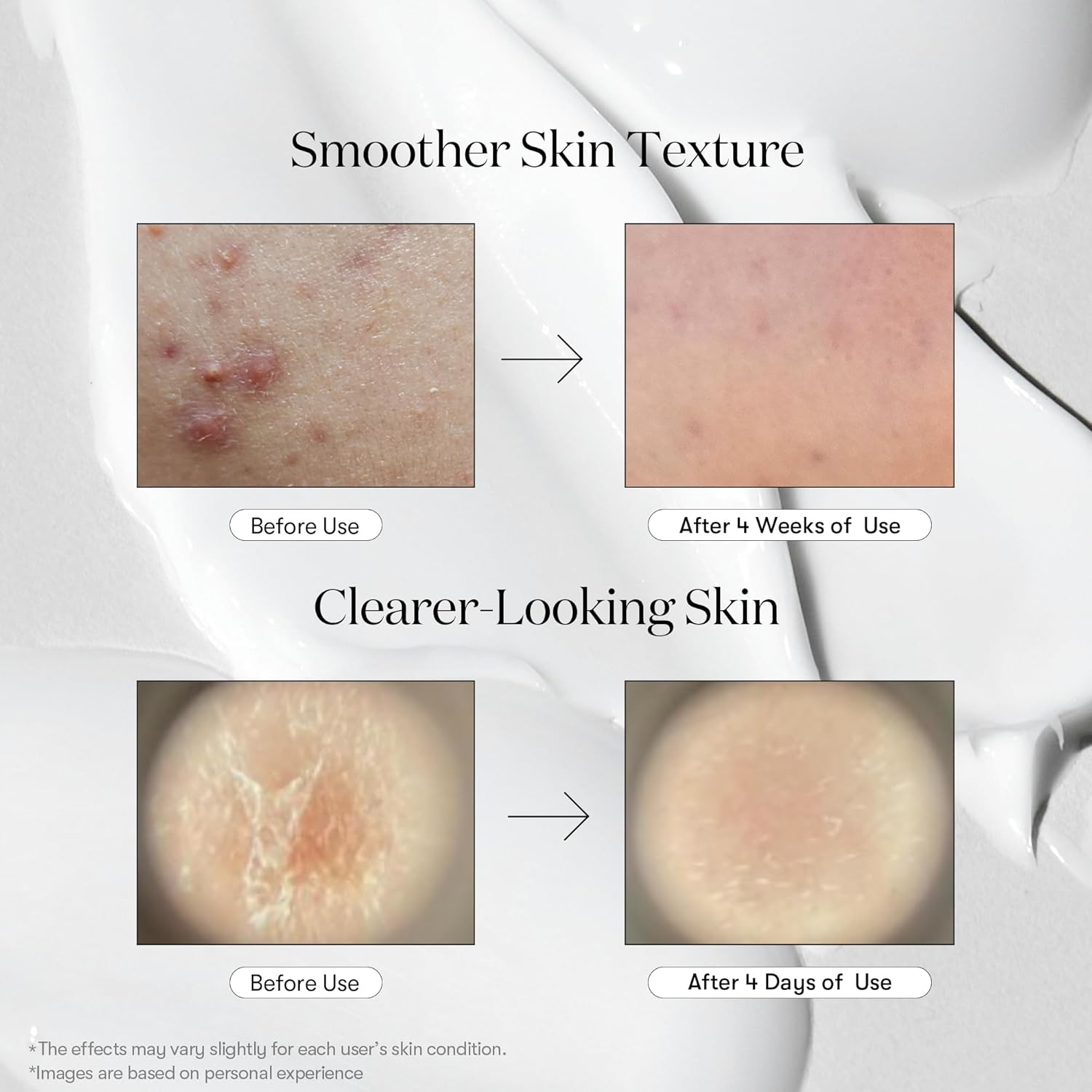 VT COSMETICS CICA Reedle Shot 100, Spicule Microneedling Serum for Pore Care & Exfoliation, Exosome, Centella Asiatica for Glass Skin, Skin Texture, Korean Liquid Skin Booster (1.69 Fl Oz / 50ml)