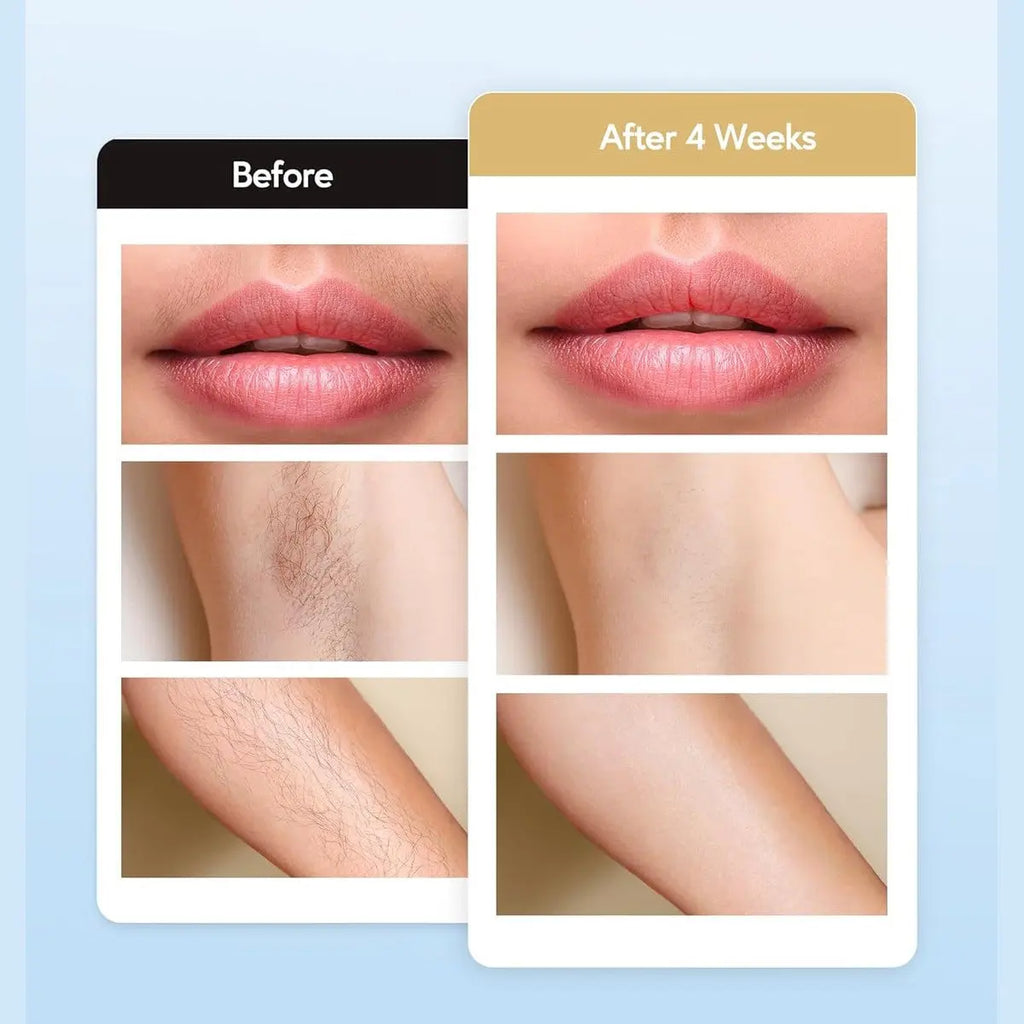 IPL Hair Remval Device with Ice Cooling Function,999999 Flashes 9 Level Painless Long Lasting Hair Remover System for Facial,Bikini,Body
