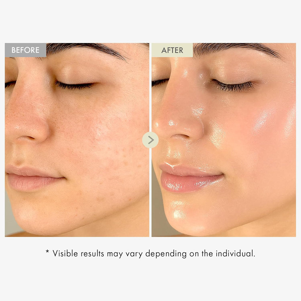 TOSOWOONG Real Collagen Face Serum, Hydrating & Firming with Hydrolyzed Collagen and Hyaluronic Acid – Supports Elasticity and Smooth-Looking Skin – Korean Skincare, 33ml, 1.11 fl. oz