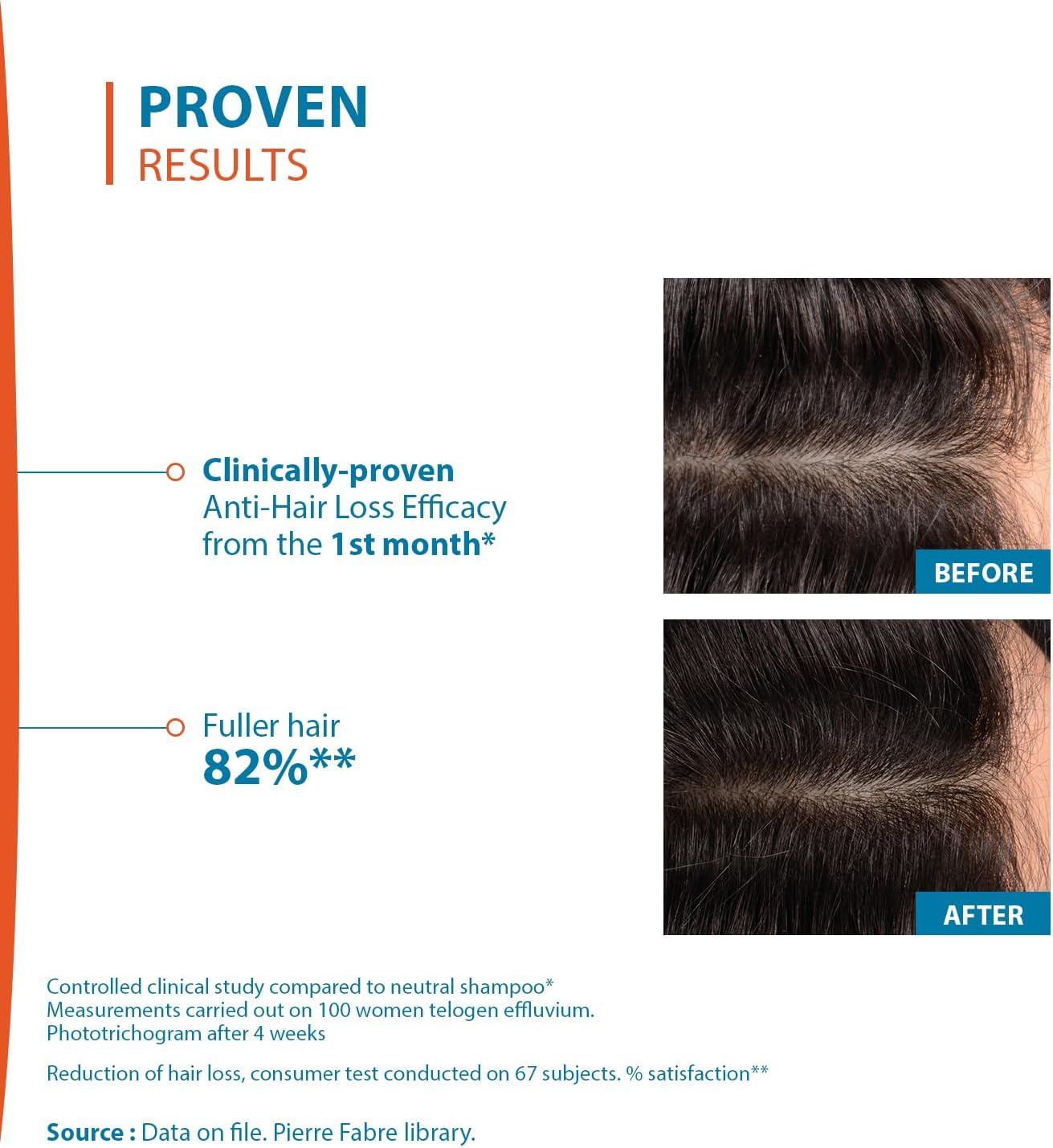 Ducray Creastim Reactiv Anti Hair Loss Lotion 60 ml