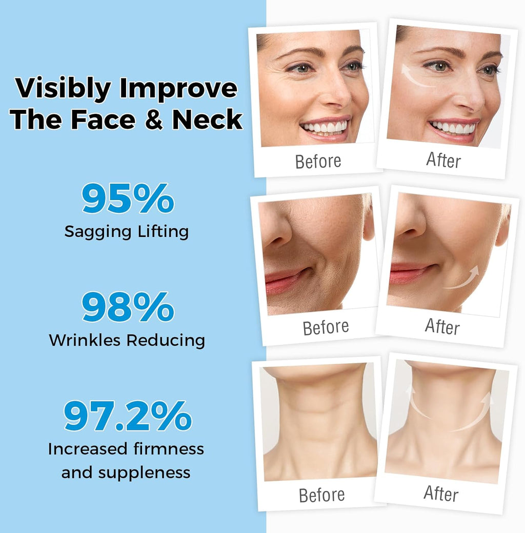 OUKEYA Retinol Cream for Face 3% Retinol Day & Night Cream, 5% Hyaluronic Acid & 5% Niacinamide, Anti Aging Moisturiser For Face & Neck, Hydrating, Firming, Non-Greasy, Fast Absorbing, 50g