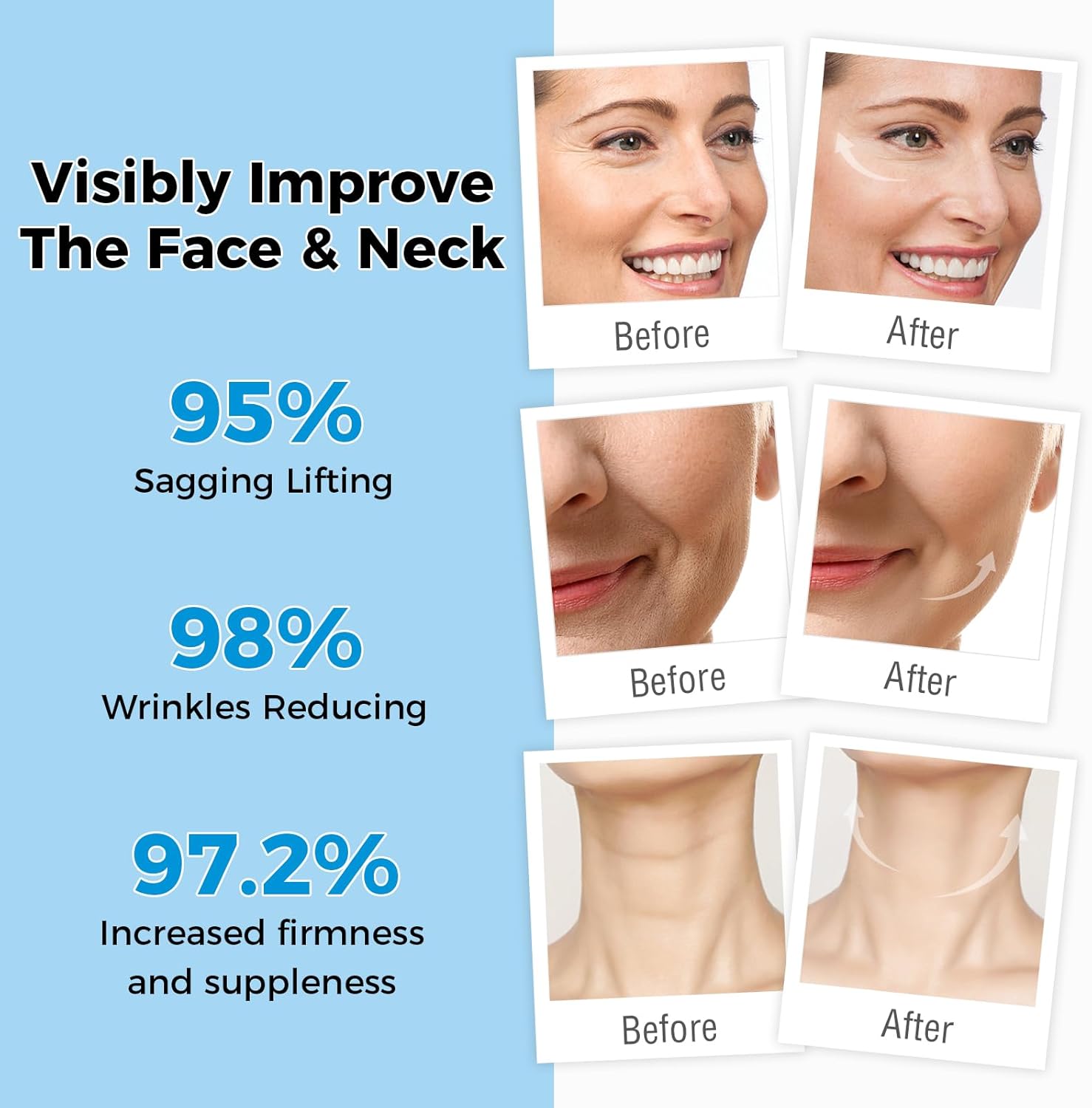 OUKEYA Retinol Cream for Face 3% Retinol Day & Night Cream, 5% Hyaluronic Acid & 5% Niacinamide, Anti Aging Moisturiser For Face & Neck, Hydrating, Firming, Non-Greasy, Fast Absorbing, 50g