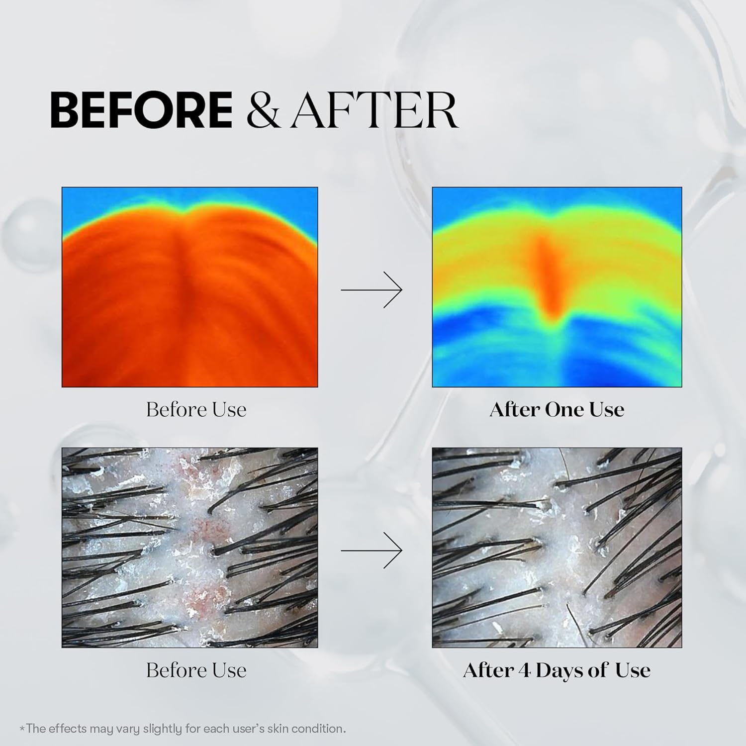 VT COSMETICS PDRN REEDLE SHOT HAIR AMPOULE 100dl, Vegan PDRN, Slow aging, Scalp treatment