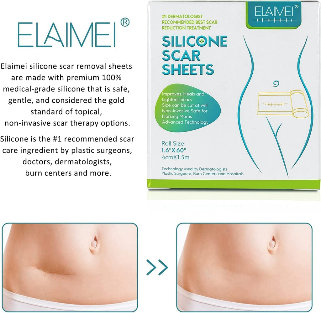 Wifamy Silicone Scar Sheets(1.6'' x 60''Roll-1.5M) - Soft Silicone Gel Scar Tape Painless Silicone Tape Roll - Effective Silicone Scar Removal Strips Sheets for C-Section & Keloid Surgery, Burn, Acne