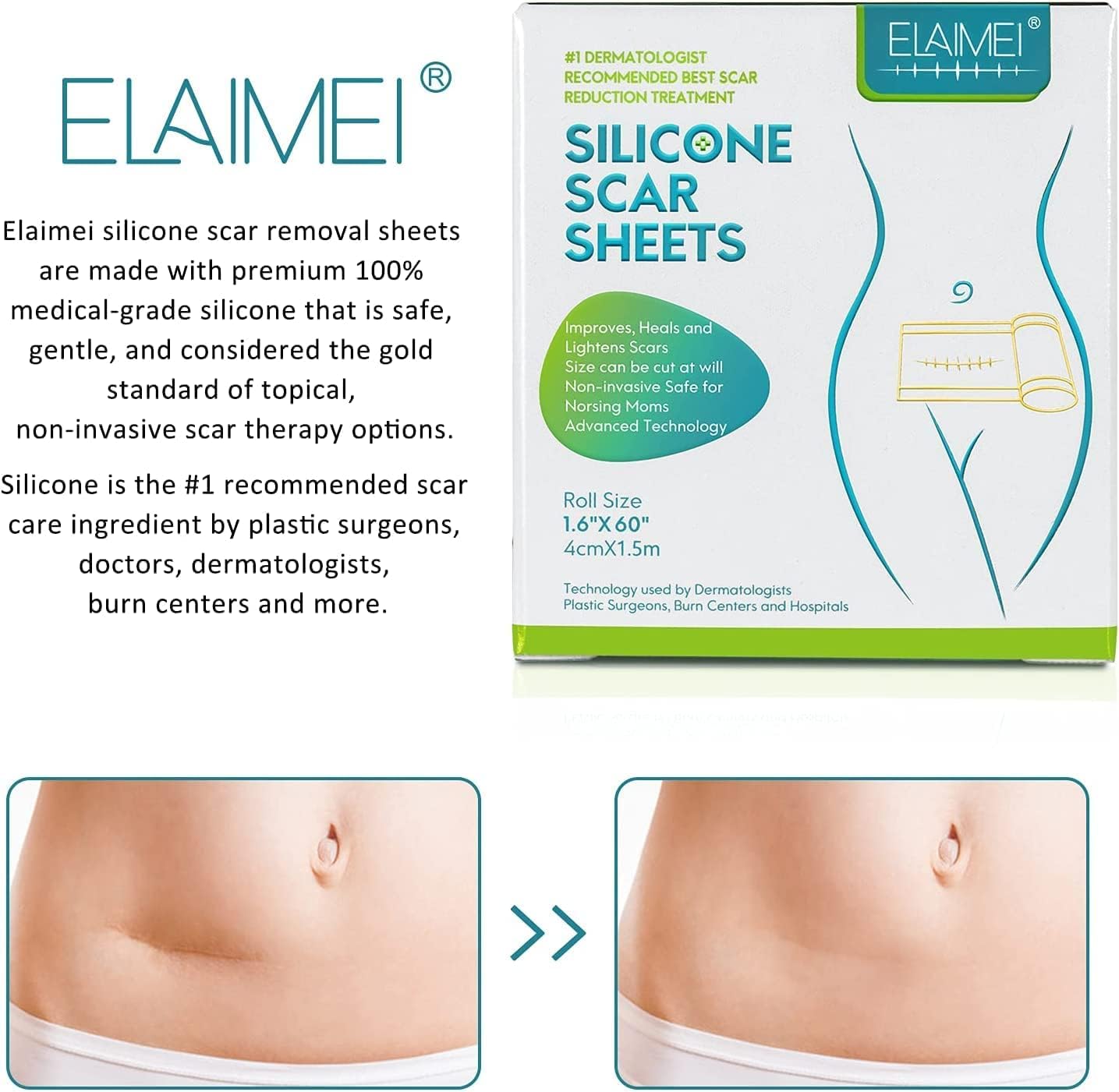 Wifamy Silicone Scar Sheets(1.6'' x 60''Roll-1.5M) - Soft Silicone Gel Scar Tape Painless Silicone Tape Roll - Effective Silicone Scar Removal Strips Sheets for C-Section & Keloid Surgery, Burn, Acne