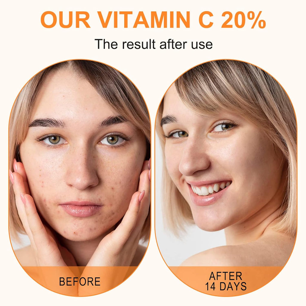 ELBBUB Premium 20% Vitamin C Serum For Face, with Hyaluronic Acid, Retinol & Amino Acids - Boost Skin Collagen, Brighten Hydrate & Plump Skin, Anti Aging & Wrinkle Facial Serum
