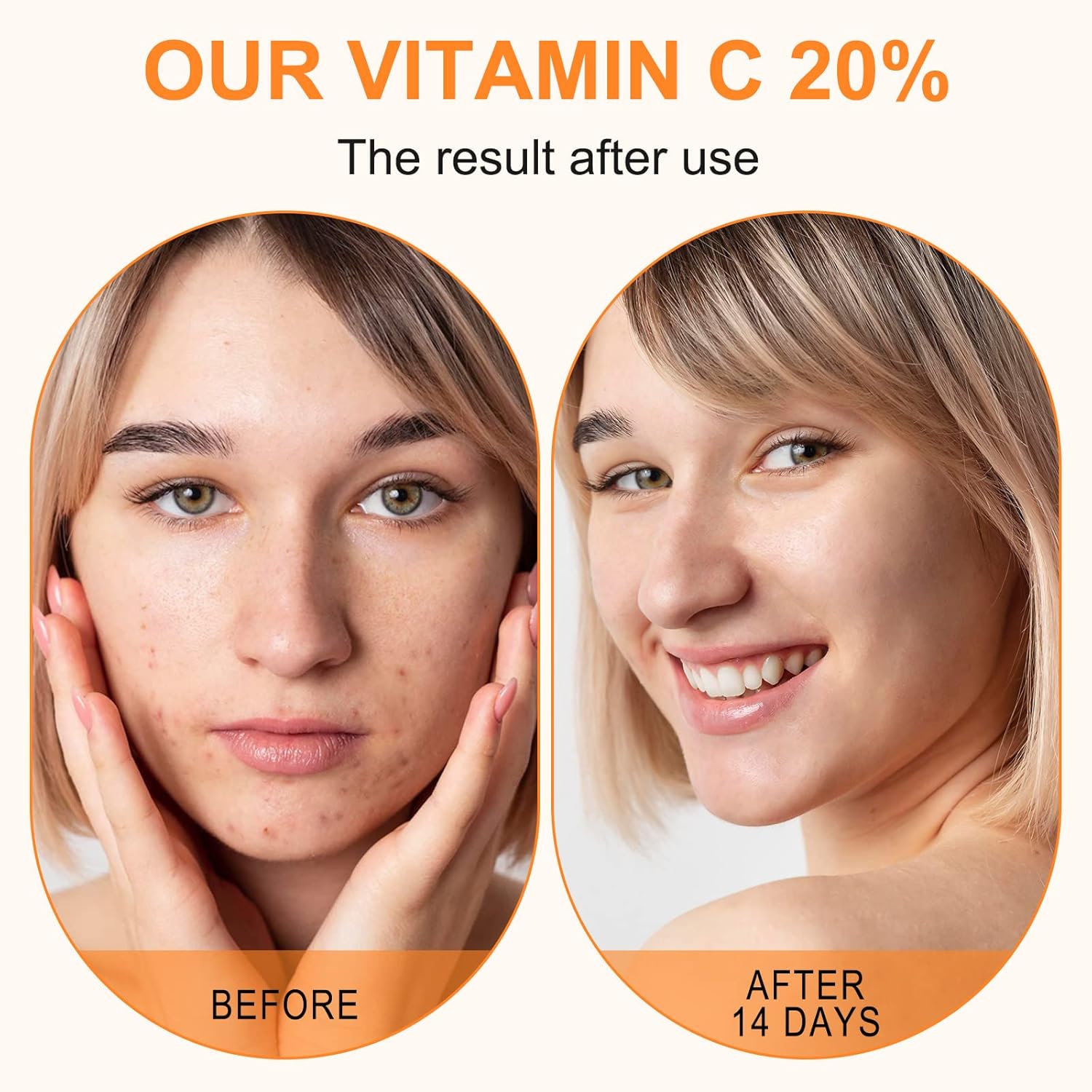 ELBBUB Premium 20% Vitamin C Serum For Face, with Hyaluronic Acid, Retinol & Amino Acids - Boost Skin Collagen, Brighten Hydrate & Plump Skin, Anti Aging & Wrinkle Facial Serum