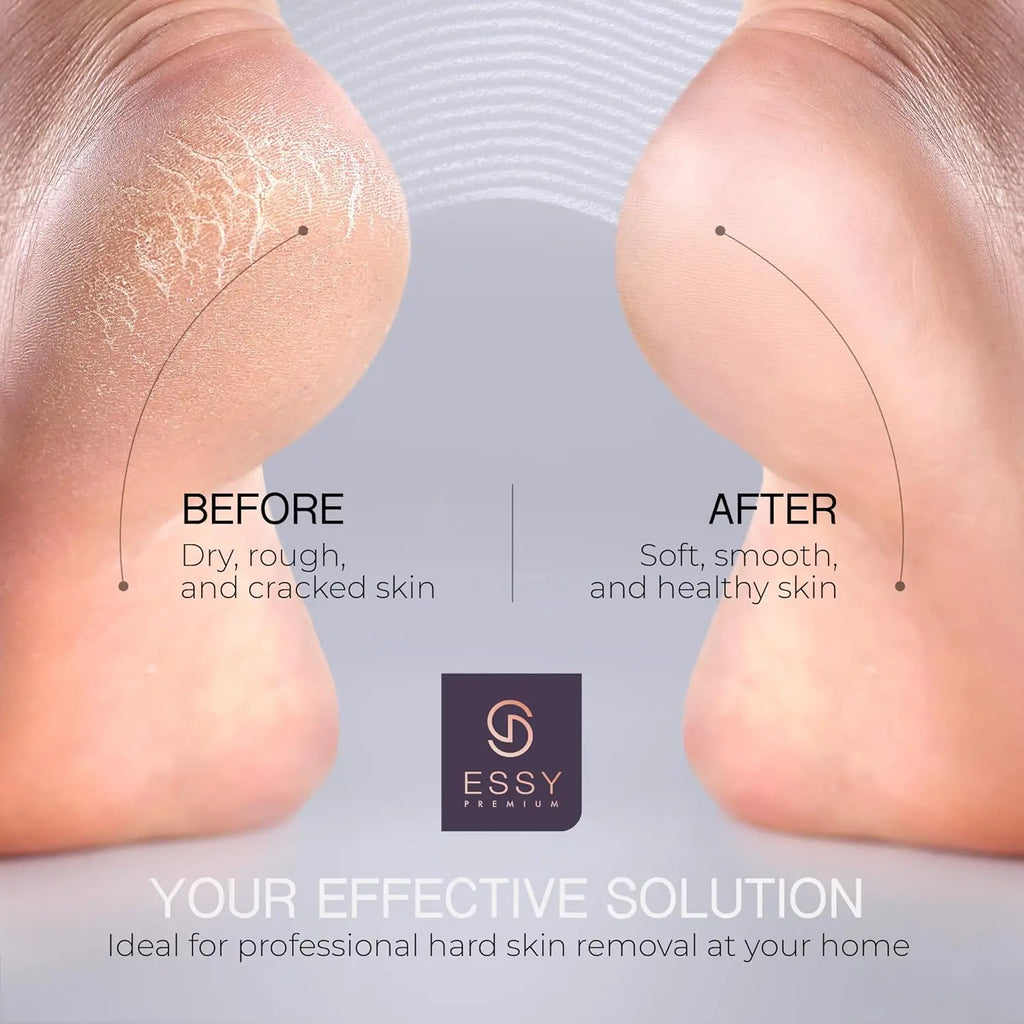 Essy Electric Foot File Pedicure Feet Hard Skin Remover Foot Scraper Dry Dead Skin Remover Callus Exfoliator Rechargeable Feet Scrubber with 5 Replacement Rollers Foot Care Skin Removers