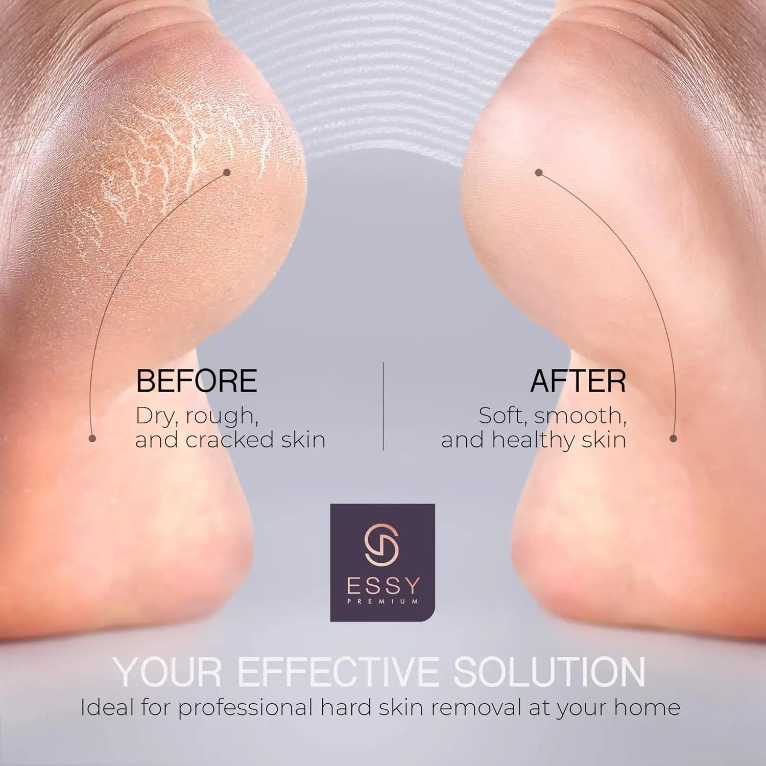 Essy Electric Foot File Pedicure Feet Hard Skin Remover Foot Scraper Dry Dead Skin Remover Callus Exfoliator Rechargeable Feet Scrubber with 5 Replacement Rollers Foot Care Skin Removers