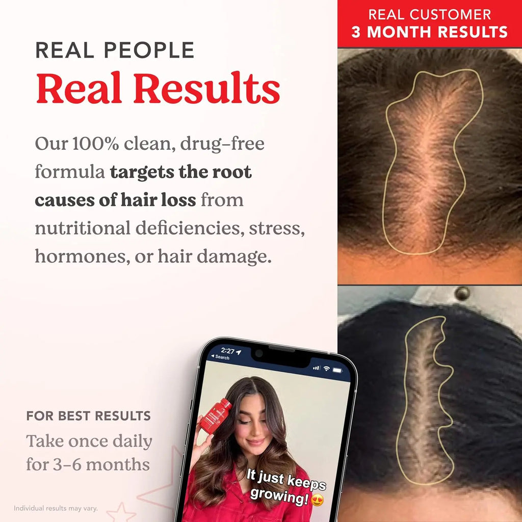Real people real results HAIRtamin testimonial showing increased hair density over time