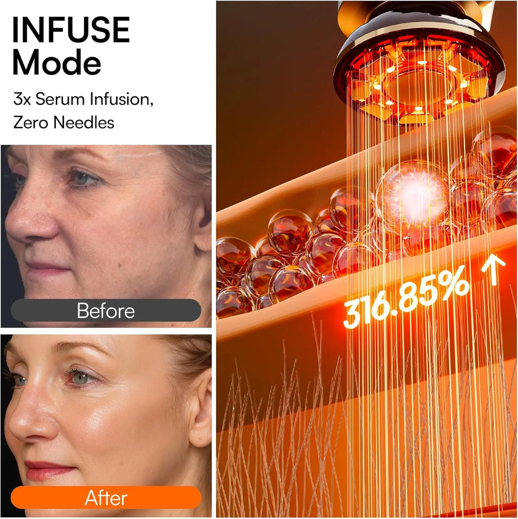 INIA Light Therapy Beauty Device for Facial, Skin Tightening, Fights Aging Skin