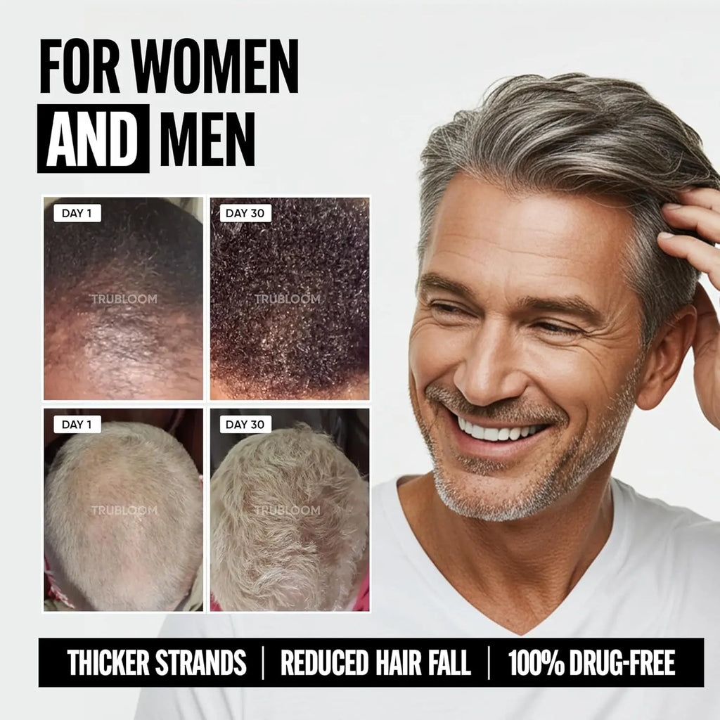 Man checking hair density with TRU BLOOM before and after treatment comparison photos
