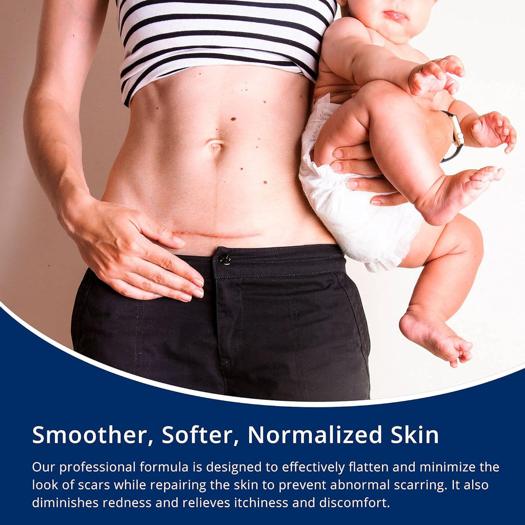 MURASAKI BEAUTY Scar Gel silicone scar gel from C-Section, Stretch Marks, Acne, Surgery, Effective for both Old and New Scars