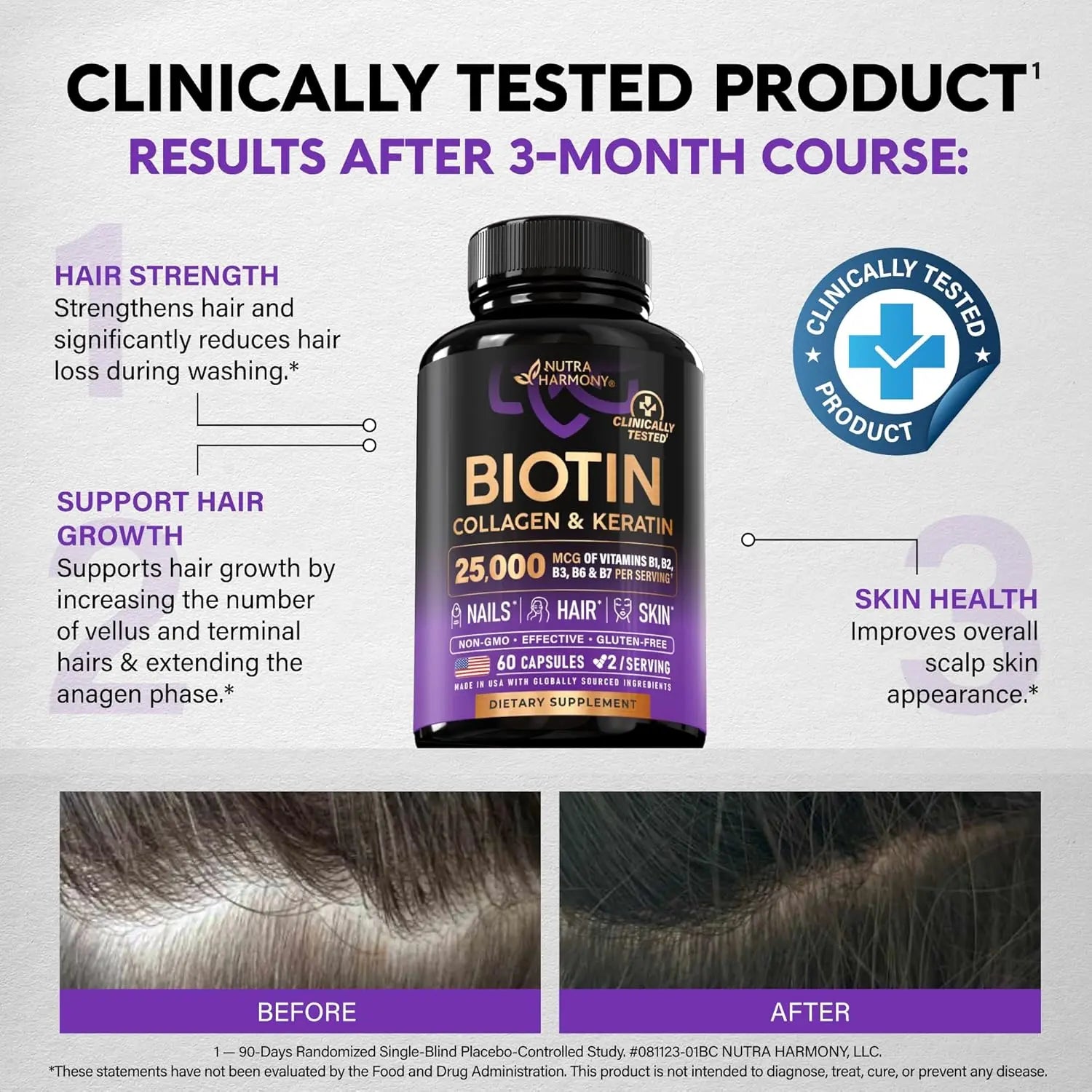 Biotin | Collagen | Hyaluronic Acid | Keratin - Hair Growth & Strength Support Vitamins - Skin & Nails Supplement - Clinically Tested for Men & Women - 25000mcg Vitamins B1, B2, B3, B6 & B7 - 60 Caps