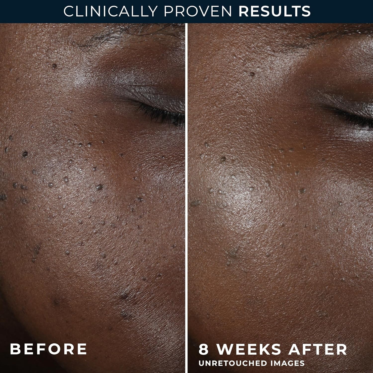 RoC Multi Correxion 5 in 1 Restoring/Anti Aging Facial Night Cream with Hexinol, 1.7 Oz (Packaging May Vary)